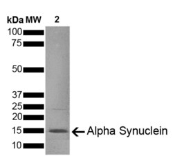 Sino Biological&nbsp;Recombinant Mouse alpha-Synuclein Protein (Full Length)